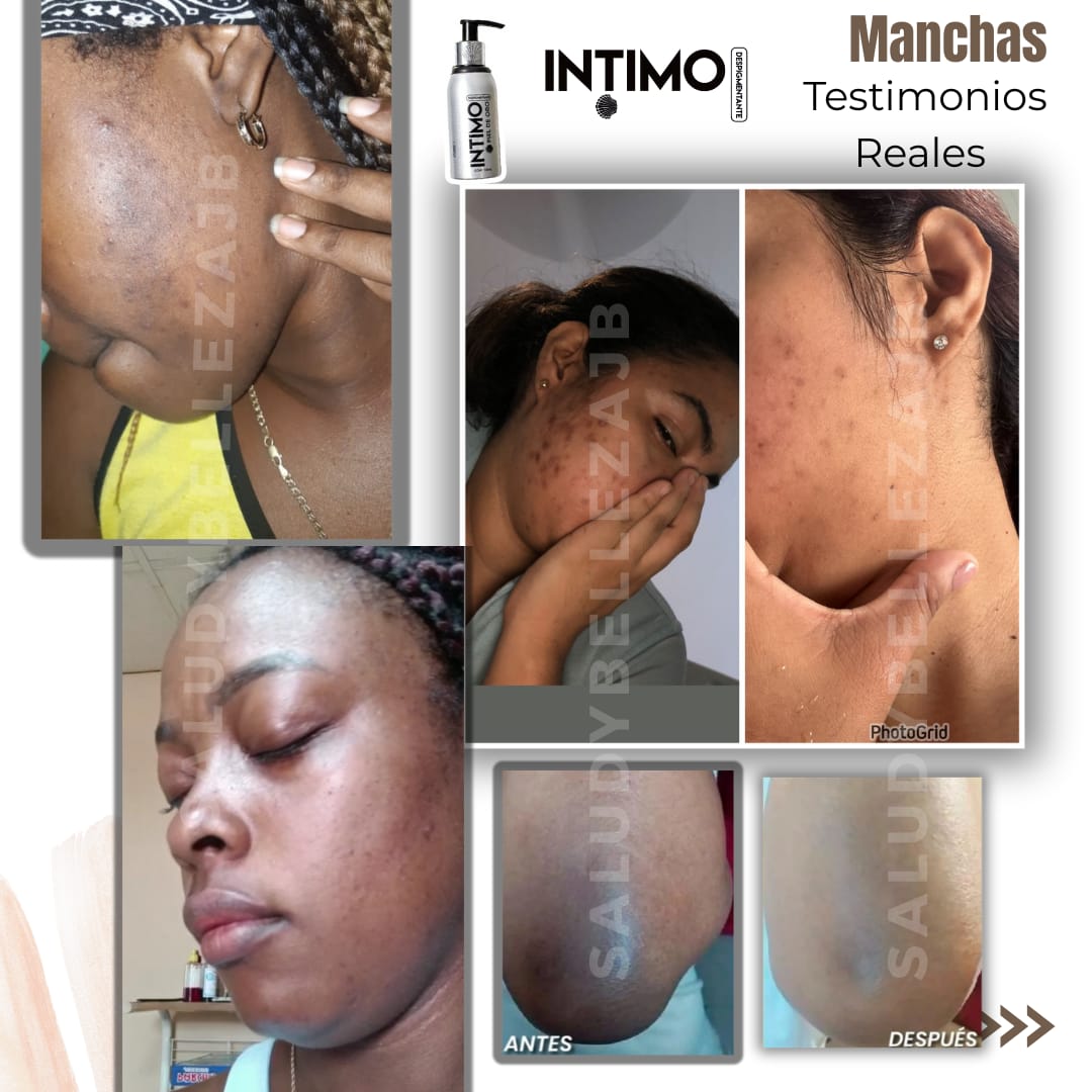 Kit Antimanchas y Antifoliculitis/Antiacné