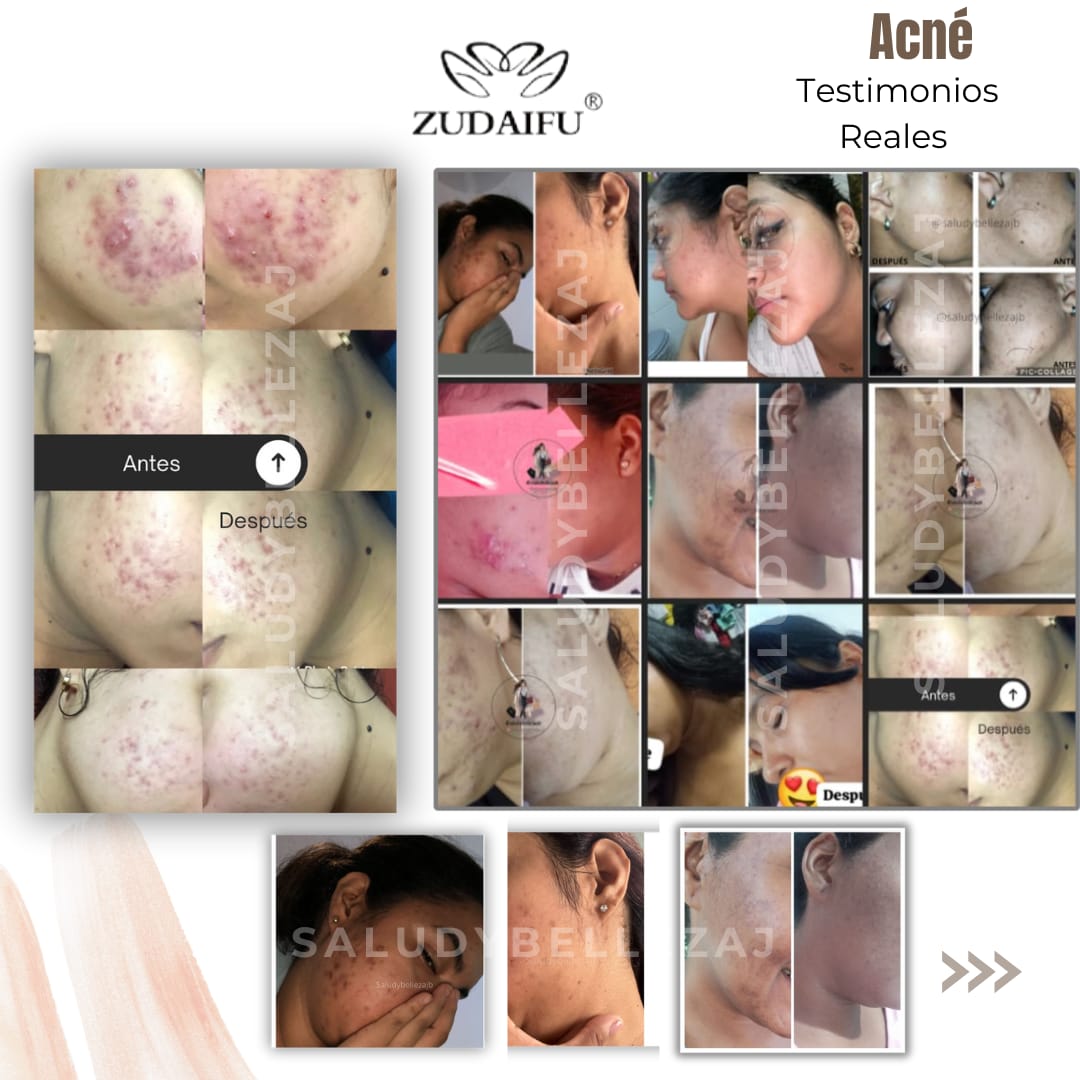 Kit Antimanchas y Antifoliculitis/Antiacné
