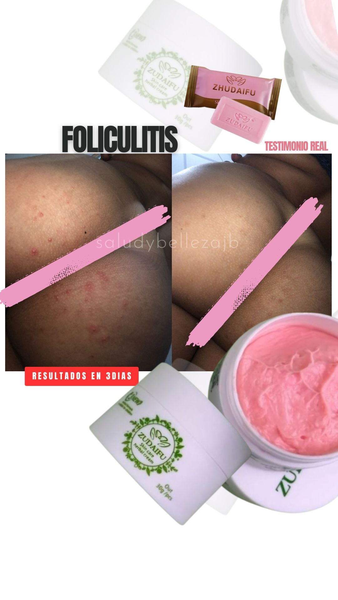Kit Antimanchas y Antifoliculitis/Antiacné