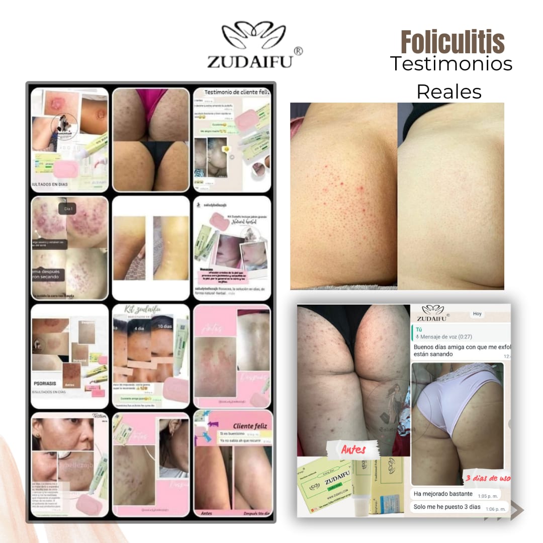 Kit Antimanchas y Antifoliculitis/Antiacné