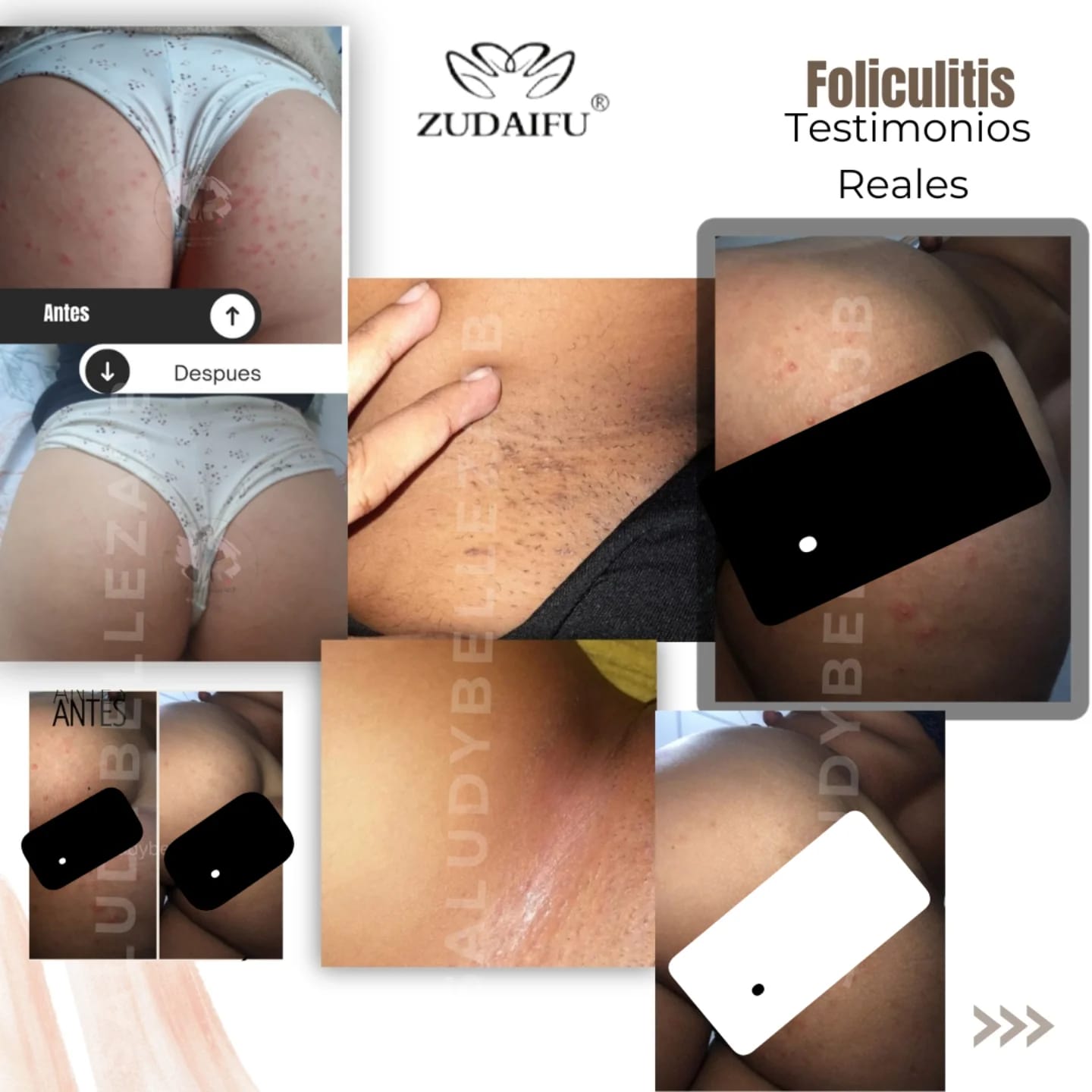 Kit Antimanchas y Antifoliculitis/Antiacné