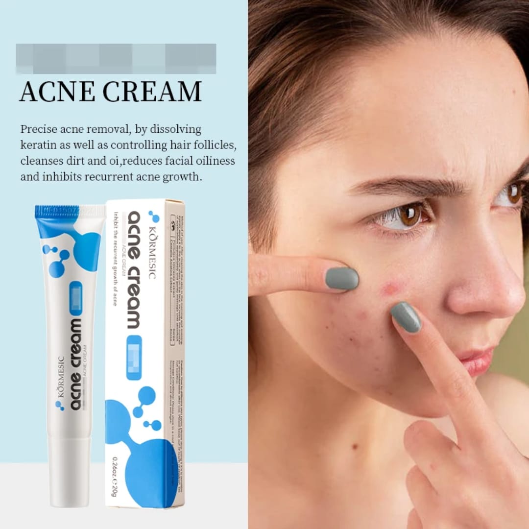 Acné Cream  Acné comedogenico y puntos negros