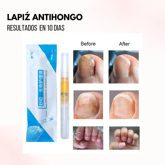 Lapiz antinhogo